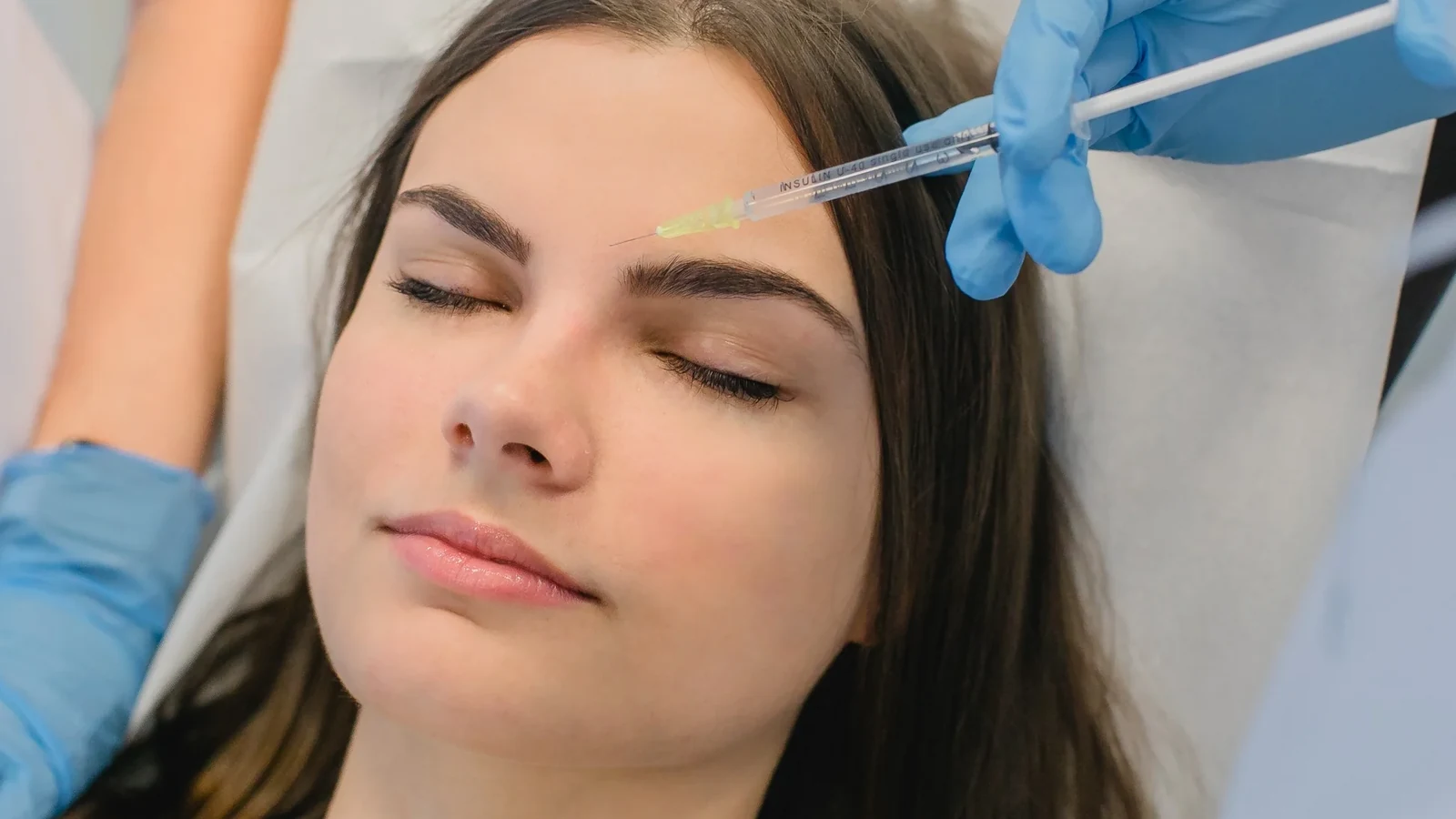 Botulinumtoxin Behandlung von Stirnfalten in Hannover