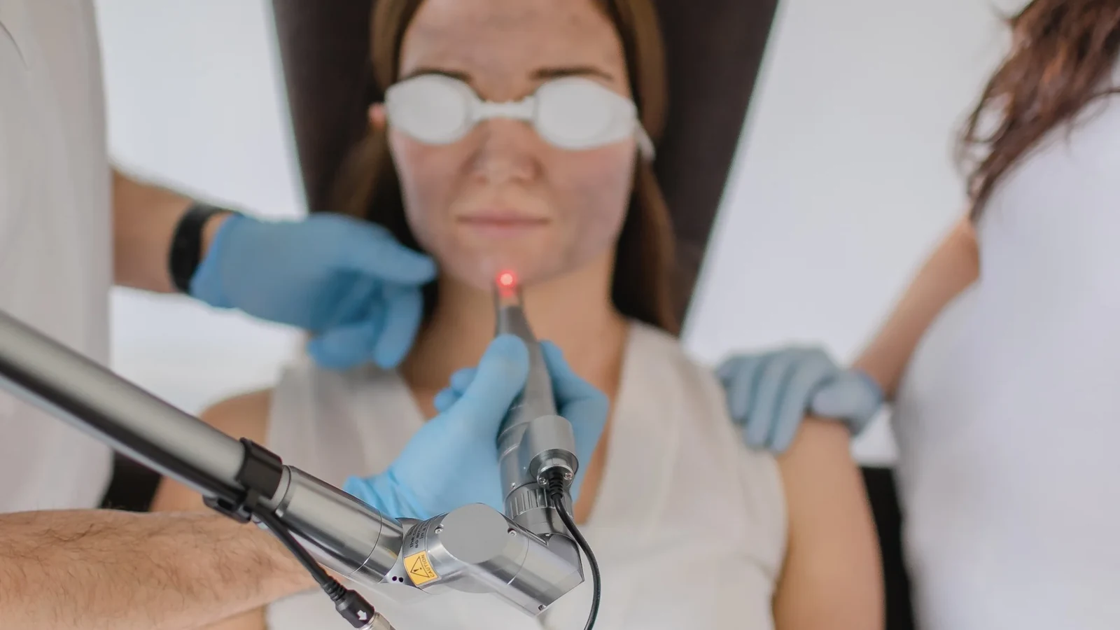 Carbon-Peeling Behandlung in Hannover