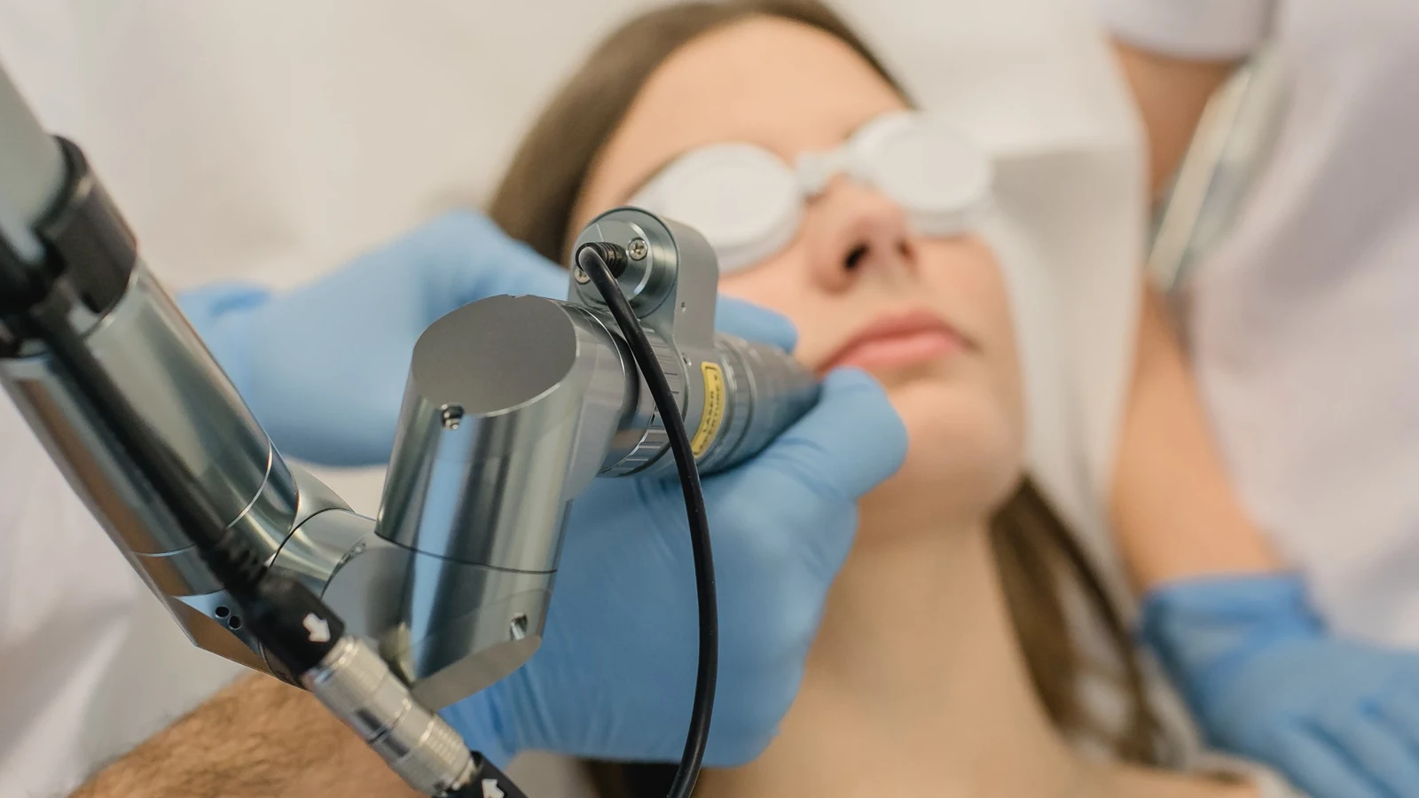 Laserbehandlung beim Carbon-Peeling in Hannover