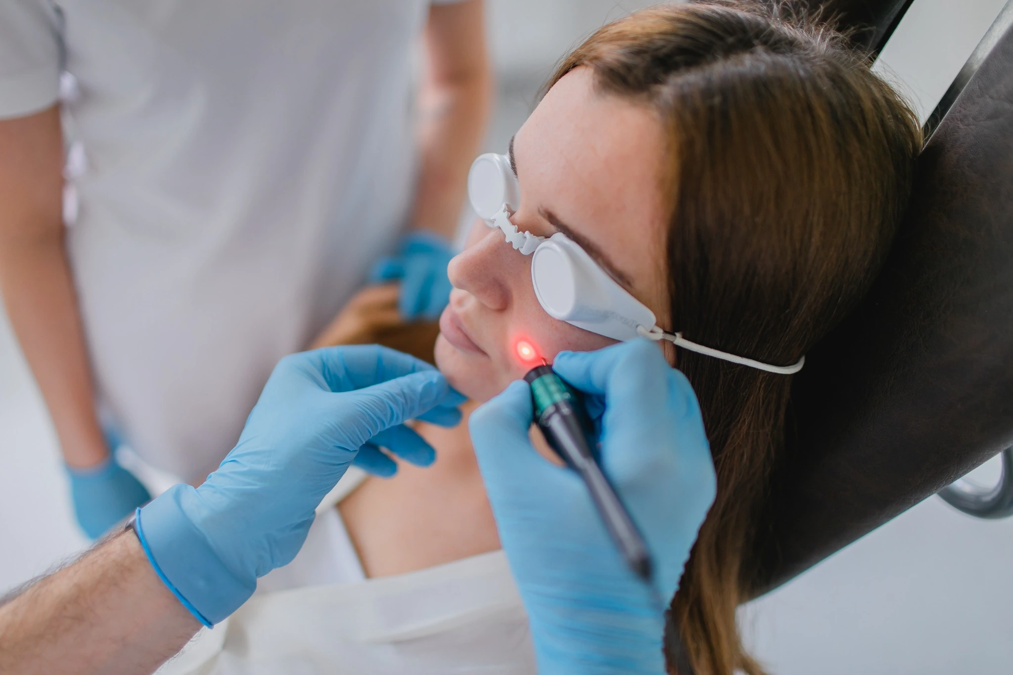 Erweiterte Äderchen Gefäßlaser Hannover