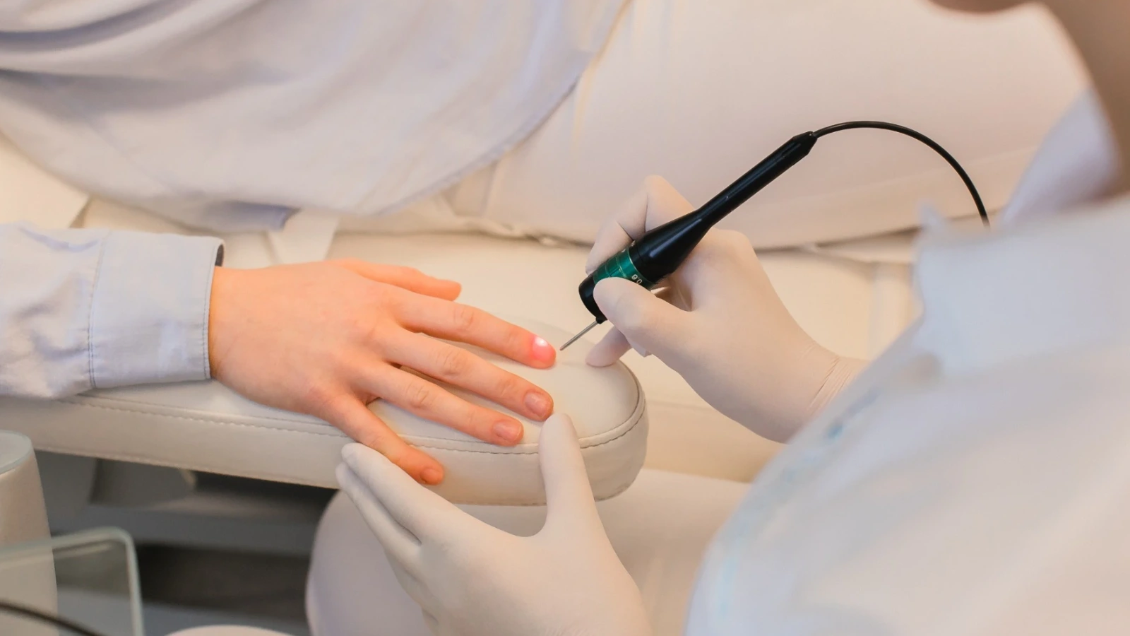 Nagellaser-Behandlung der Zehennägel in der HautarztPraxis Hannover