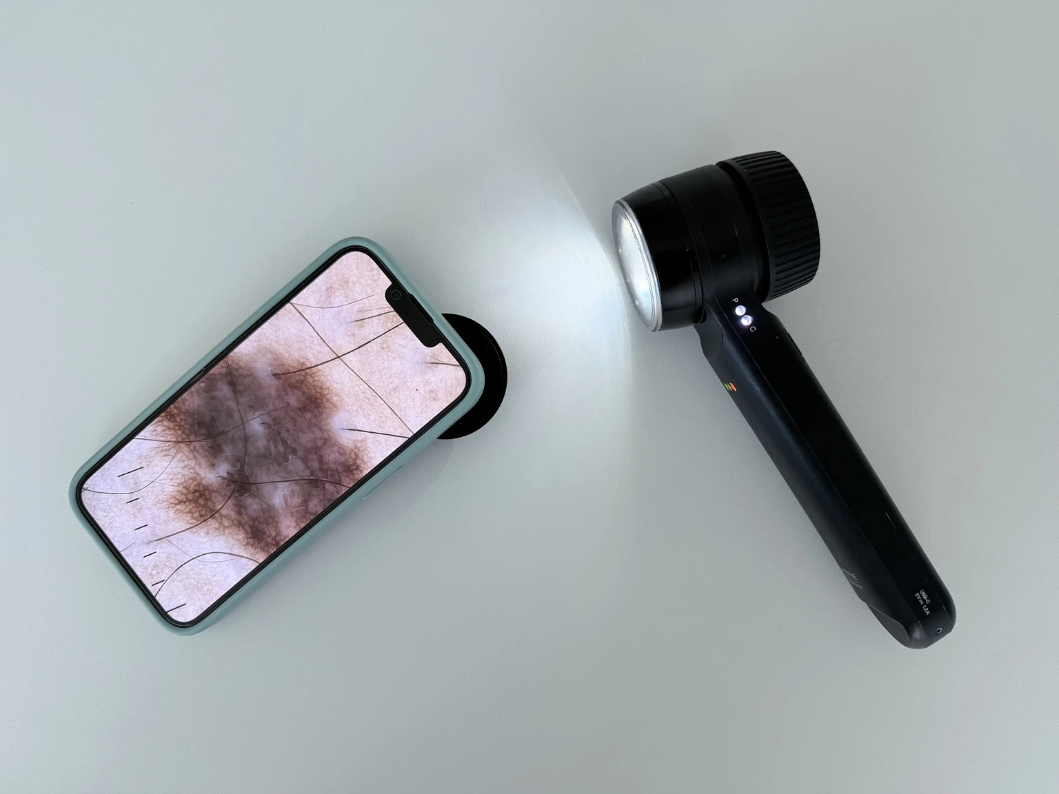 Digitale Muttermalkontrolle und Dermatoskopie in Hannover